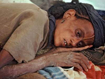 Et offer for tørken på Afrikas horn venter på medisinsk behandling i Makalle, Nord-Etiopia